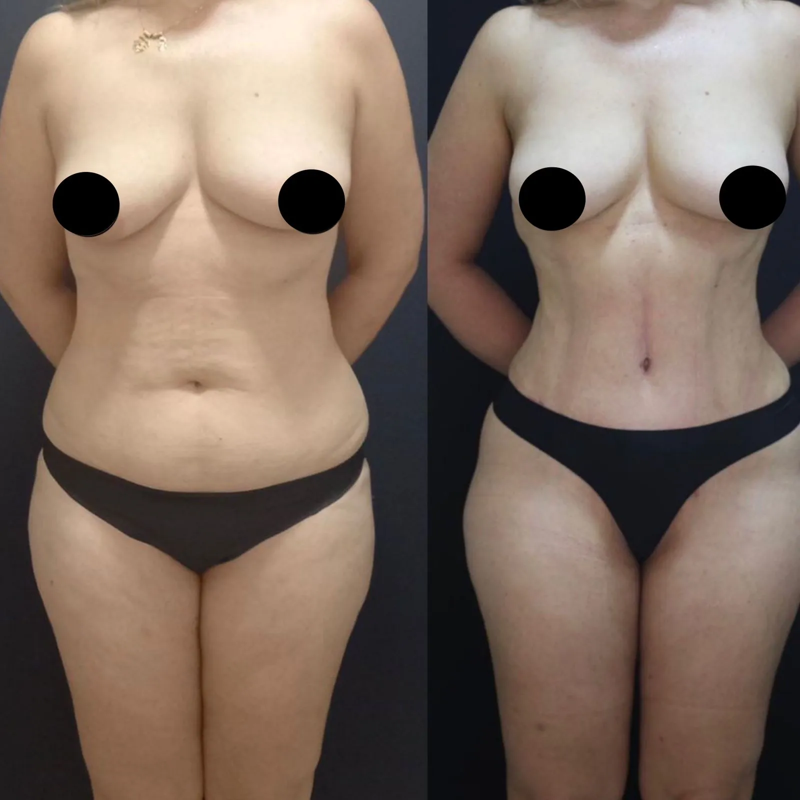 Antes e depois — resultado real
